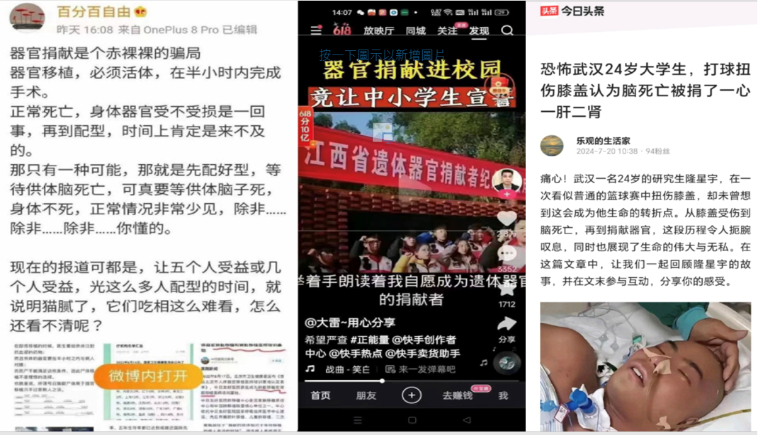 中國醫院直撥〝科普器官捐献〞网友痛骂是〝魔鬼〞 2 0703 2